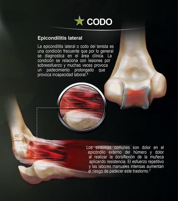 Forcedol Póster Traumatologia - 6