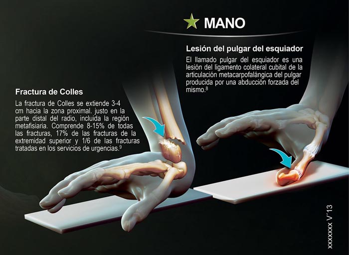 Forcedol Póster Traumatologia - 7