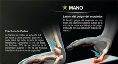 Forcedol Póster Traumatologia