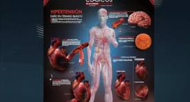Poster Renitec - CoRenitec