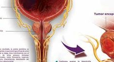 Poster Uroduo