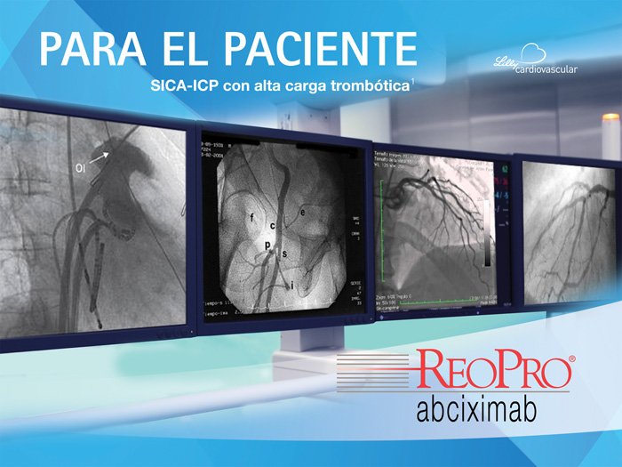 Para el paciente SICA-ICP con alta carga  trombóti - 1