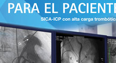 Para el paciente SICA-ICP con alta carga  trombóti