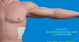 Lanzamiento Versatis