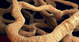 Video Osteoporosis
