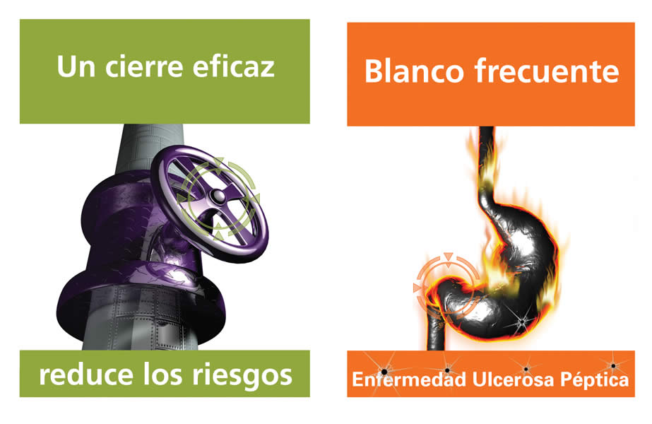 Ulsen, el IBP's - 1