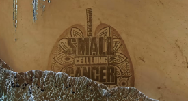 Small Things Matter